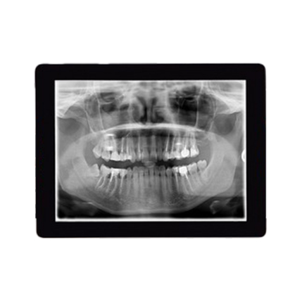 Digital x-rays