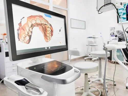 CEREC dental scanner and milling maching in Tucson and Chandler, AZ at Artistic Dentistry Arizona