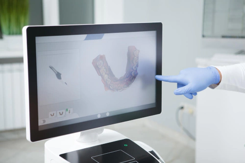 Digital Dental Scanner in Tucson and Chandler, AZ at Artistic Dentistry Arizona